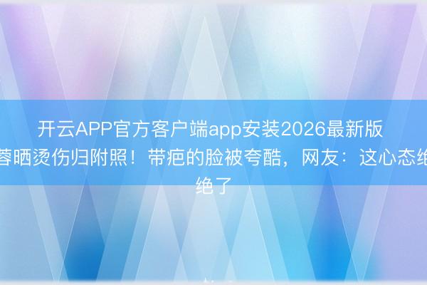 开云APP官方客户端app安装2026最新版 杨蓉晒烫伤归附照!带疤的脸被夸酷,网友:这心态绝了