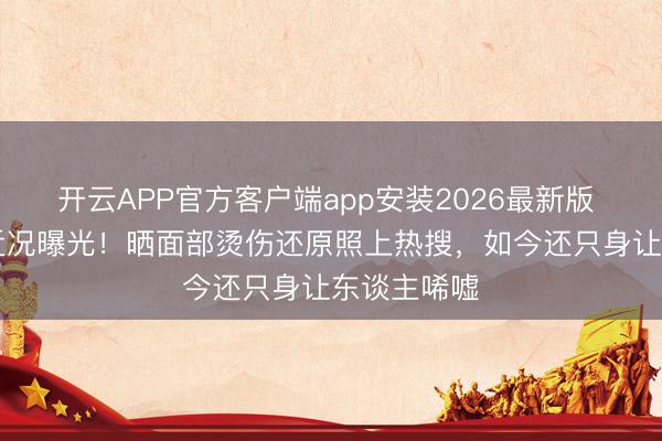 开云APP官方客户端app安装2026最新版 44岁杨蓉近况曝光！晒面部烫伤还原照上热搜，如今还只身让东谈主唏嘘